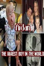 Watch Aidan The Rarest Boy In The World Megashare8