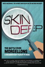 Watch Skin Deep: The Battle Over Morgellons Megashare8