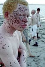 Watch Albino United Megashare8