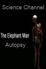 Watch Science Channel Elephant Man Autopsy Megashare8