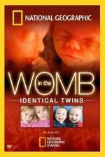 Watch National Geographic: In the Womb - Identical Twins Megashare8