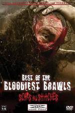 Watch TNA Wrestling: Best of the Bloodiest Brawls - Scars and Stitches Megashare8