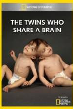 Watch National Geographic The Twins Who Share A Brain Megashare8