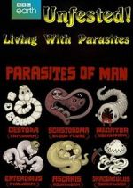 Watch Infested! Living with Parasites Megashare8