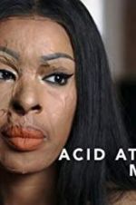 Watch Acid Attack: My Story Megashare8