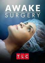 Watch Awake Surgery Megashare8