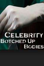 Watch Celebrity Botched Up Bodies Megashare8